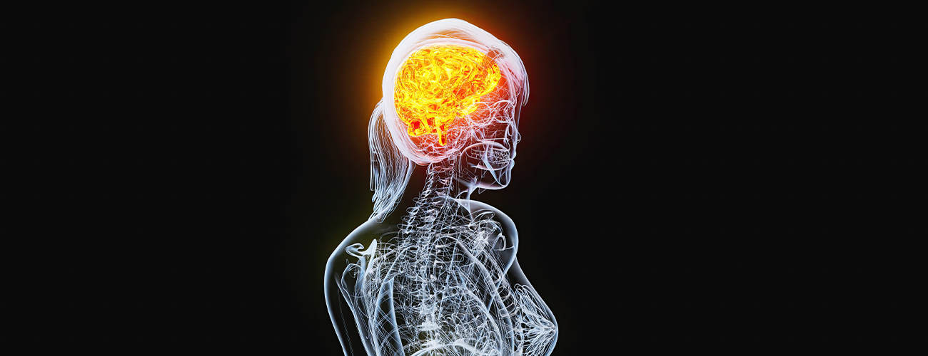 Investigation of the Effects of Quercetin on Early Brain Injury and Vasospazm in an Experimental Model of Subarachnoid Hemorrhage
